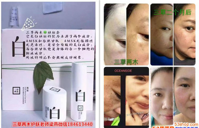去斑美白要多少钱