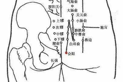痔漏是怎么回事