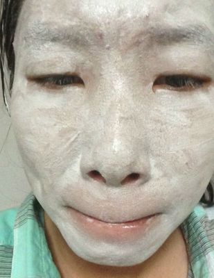 食盐可以去痘痘吗