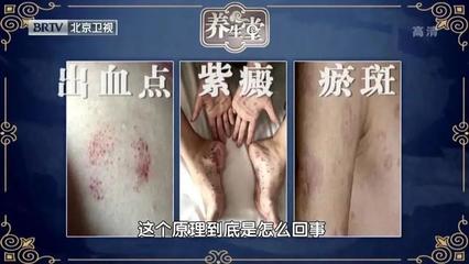 出血点是怎么回事