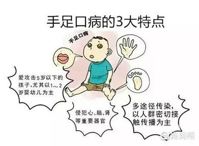 儿童手足口病怎么治疗