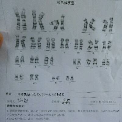 一般羊水多少正常
