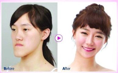 整容脸部