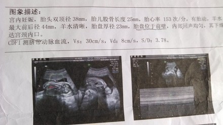 怀孕十七周有胎动吗