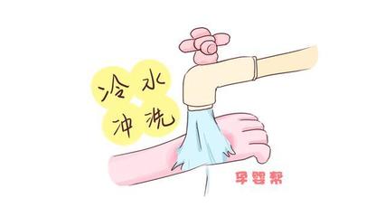 一岁宝宝烫伤怎么办