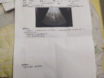 怀孕十天有什么感觉