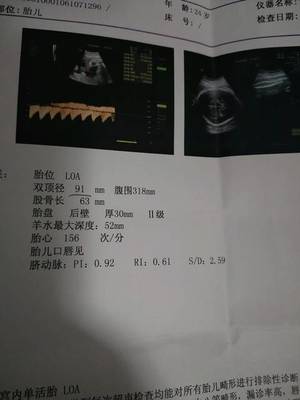 34周胎儿股骨长标准值