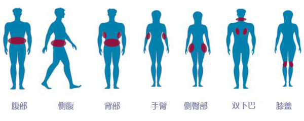 抽脂融脂