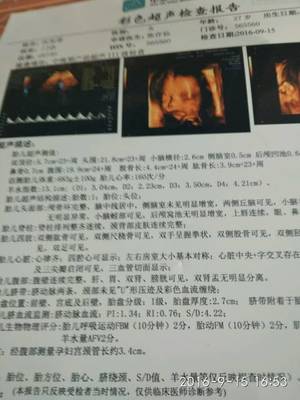 怀孕24周肚子疼是怎么回事