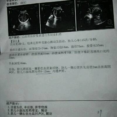 怀孕7个月胎儿有多大