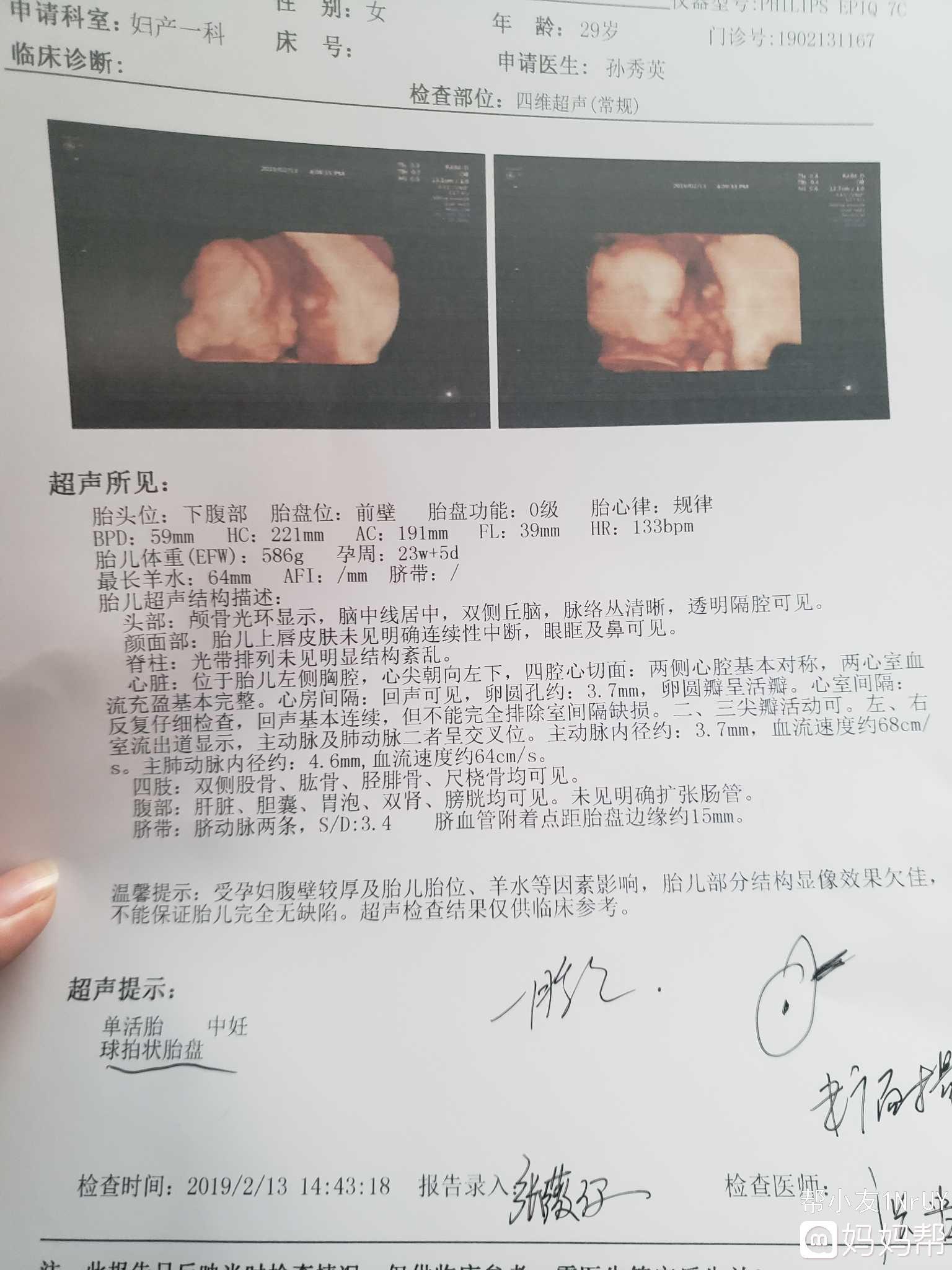 六个月球拍状胎盘可以改善吗