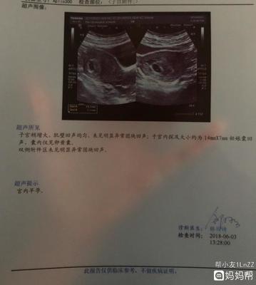 怀孕40天孩子多大