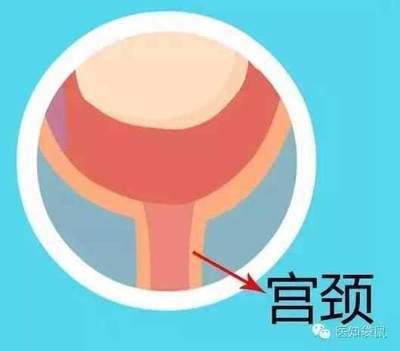 孕妇宫颈长度