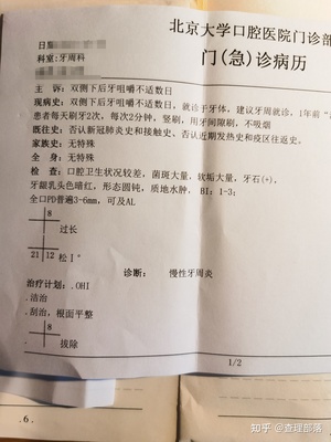 北京大学口腔医院牙周刮治多少钱