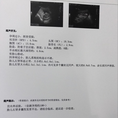 肾囊肿可以怀孕吗