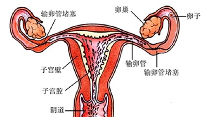 单侧输卵管怀孕的技巧