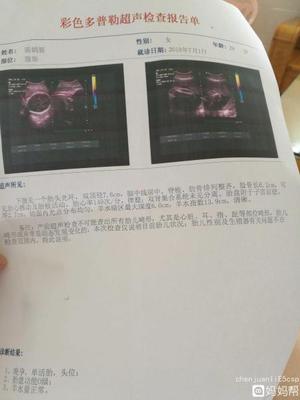胎儿发育小