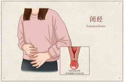 月经一个月不来怎么办