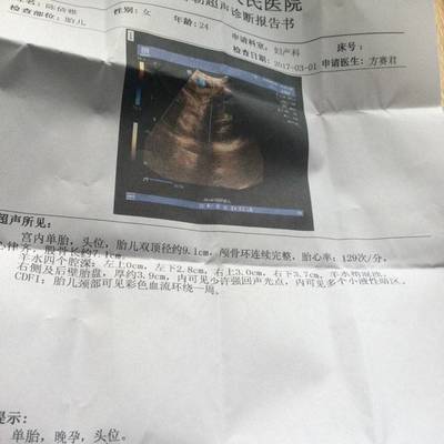3月怀孕预产期是几月