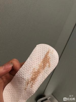 白带有点咖啡色是怎么回事