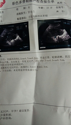 月经推迟半个月才来正常吗