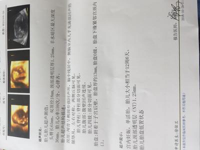 孕妇胎盘低怎么办