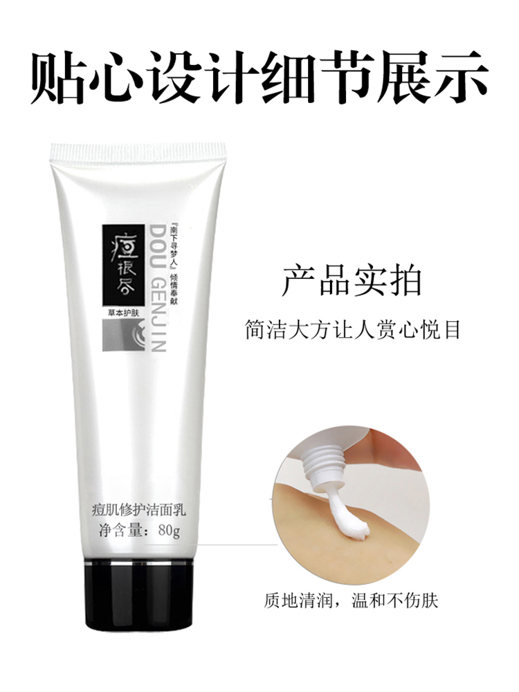 痘根尽加强版痘痘加剧