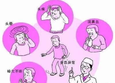 瞬间晕厥是怎么回事