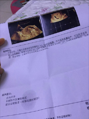 输卵管不通是怎么回事