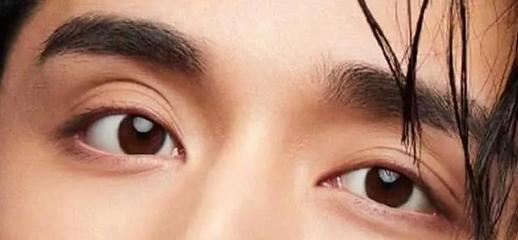 眼眶深陷是怎么回事
