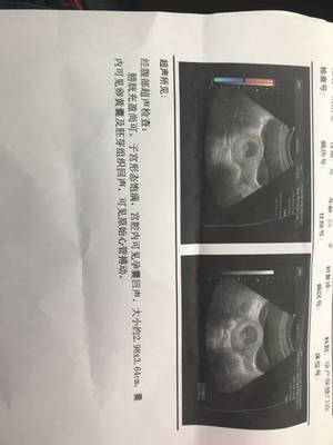 怀孕初期吃头孢对胎儿有影响吗