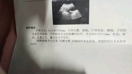 怀孕多少天建档