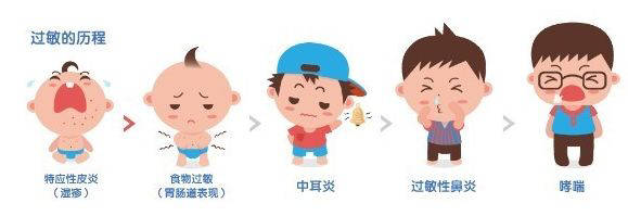 幼儿反复咳嗽