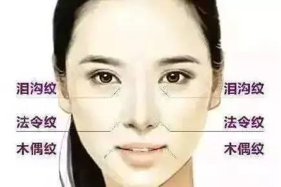 人的法令纹