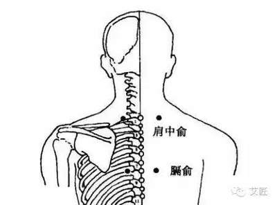 肩中俞疼是怎么回事