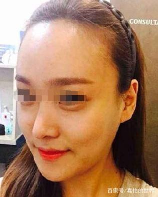 鼻翼一大一小面相