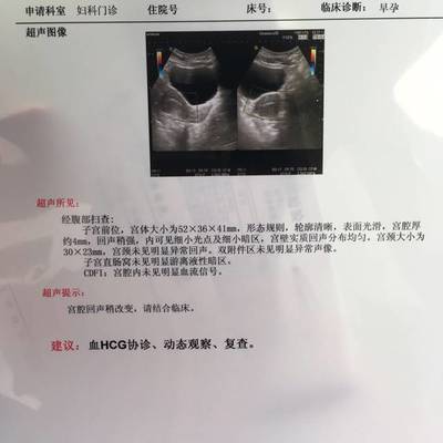 怀孕40天流产需要清宫吗