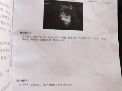 怀孕2个月最准看男女