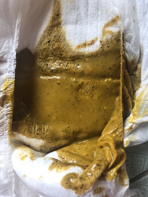 宝宝拉屎有黑色颗粒