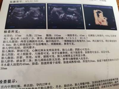 胎儿心率148