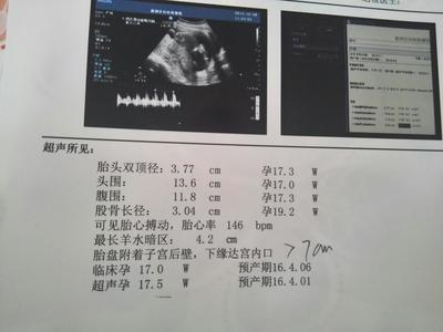四个月双顶径多少正常