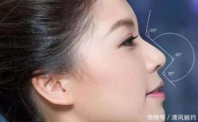 隆鼻等老了以后后遗症
