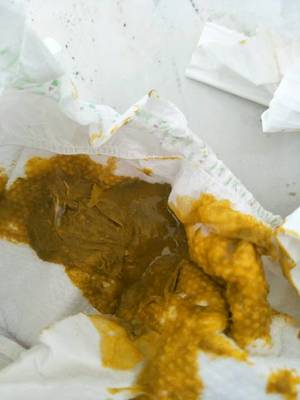 宝宝拉绿便怎么办