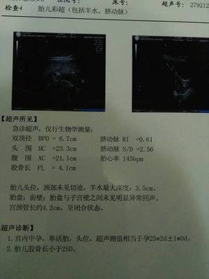 单脐动脉多少周能查出来吗