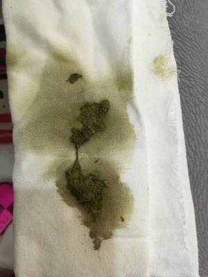 新生儿拉屎有泡沫怎么回事
