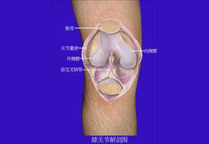 髌骨关节炎怎么治疗