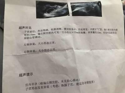 怀孕半个月肚子疼