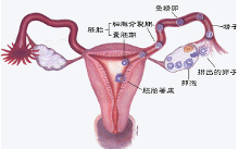 输卵管结核怎么治疗