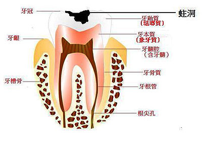 不补牙有什么危害