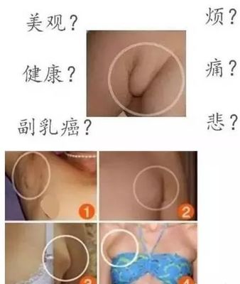 一岁宝宝耳后淋巴结肿大怎么办